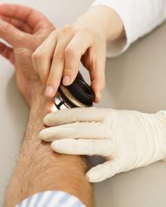 Dermatoscopes reviewing skin spots to assess for skin cancer